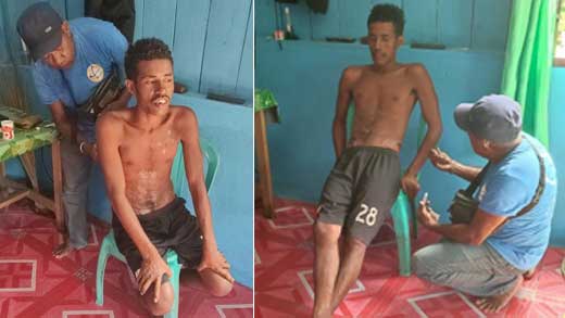 Ferdinan Morin (18), Seorang Korban Laka Laut di Waropen Ditemukan dalam Kondisi Selamat di Dawai Yapen Timur