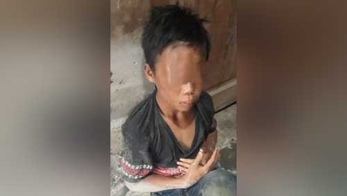 Korban penganiayaan Jakaria Sihotang