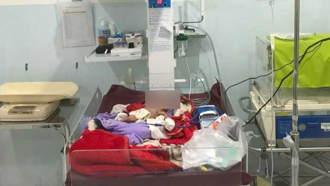 Muhammad Azam, bayi prematur ini lahir pada 13 September 2023 di RS Rizki Bunda Lubuk Basung mengalami gizi buruk.